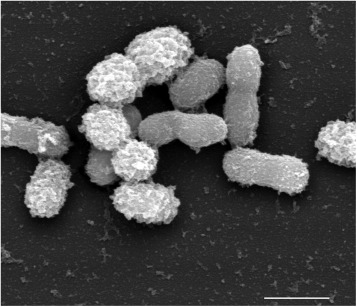 Next Generation Probiotics Akkermansia massiliensis